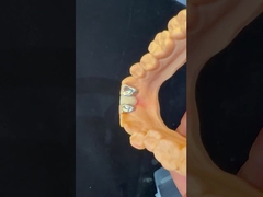 Dentes Dentários PFM Maryland Bridge Alta Estética Certificado FDA