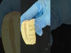 Coroa de zircônio de contorno completo / alta estética natural personalizada de assistite zircônio ponte dental