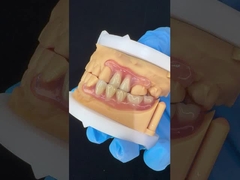 Modelo de impressão 3D Alta estética Dental TCS Valplast Flexíveis Dentes Parciais Dentários Laboratório Dental