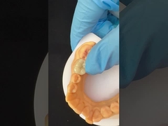 Força Emax Coroa de folheados cerâmicos com excelente resistência a manchas / biocompatibilidade