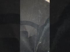 Dentaduras de apoio de implantes de titânio Dentaduras de precisão Ivoclar sobre implantes