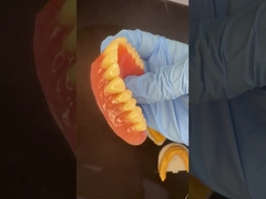 Dentes completos de base e superior Dentes parciais de acrílico Dentes ivoclares Goma rosa