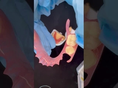 Modelo de impressão 3D Alta estética Dental TCS Valplast Flexíveis Dentes Parciais Dentários Laboratório Dental