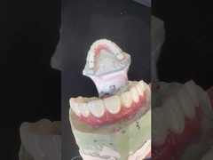 Dentes claros Retentor ortodôntico Alta estética Retentor Essix